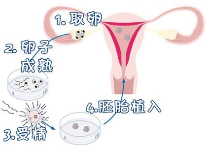 关于丹韵生殖